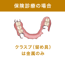 保険診療の場合 クラスプ（留め具）は金属のみ