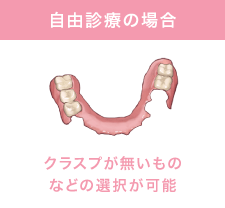 自由診療の場合 クラスプ（留め具）がないものなどの選択が可能