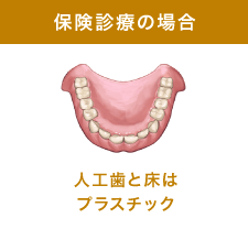 保険診療の場合 人口歯と床はプラスチック