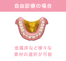 自由診療の場合 金属床などの様々な素材の選択が可能